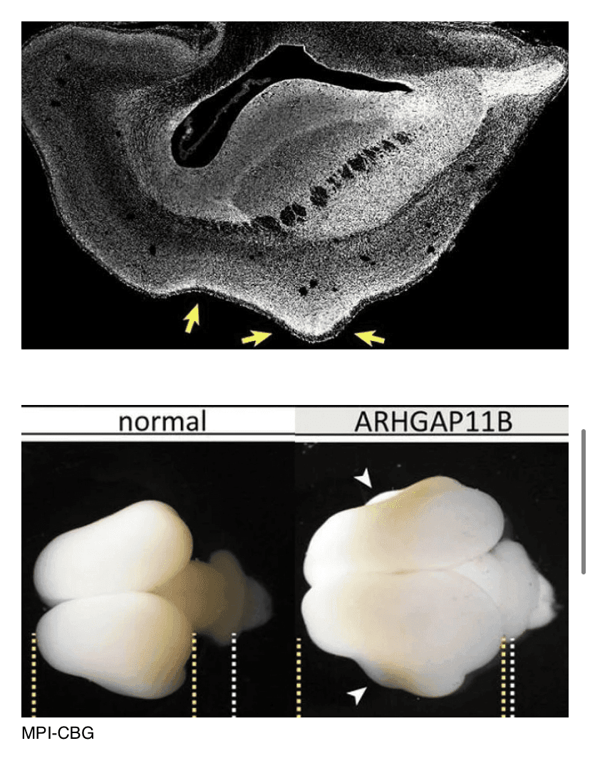 (과학) 원숭이뇌가 인간처럼 커졌어요  게시글 썸네일