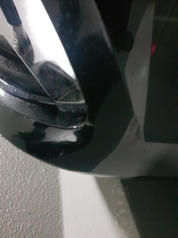 사고부위 궁금중.. 게시글 썸네일