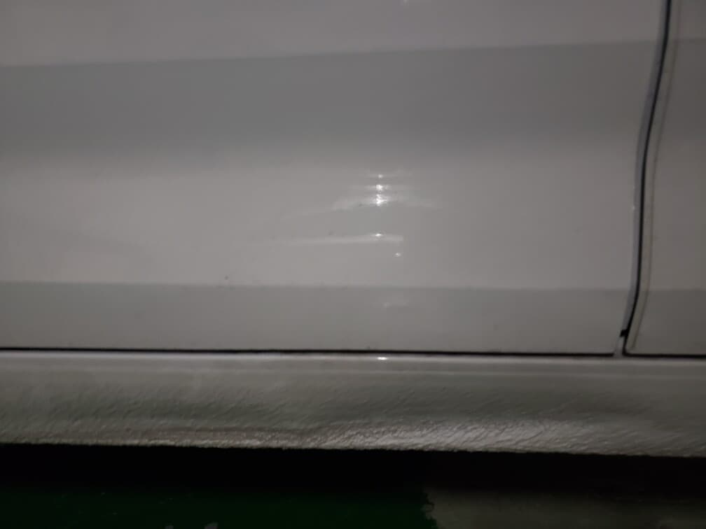 고칠까요 말까요? ㅠ 게시글 썸네일